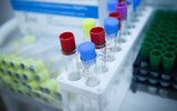 В России создали медицинский тест сразу для 25 вирусов