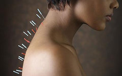 Фото с сайта acupunctureclinicnw.com