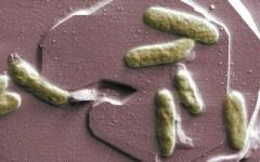 Бактерия Shewanella oneidensis. Фото с сайта emsl.pnl.gov