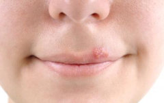Фото с сайта theherpes.ru