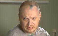 Олег Кашин после избиения. Кадр телеканала «Дождь»