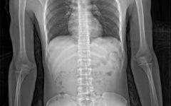 Фото с сайта rsna.org