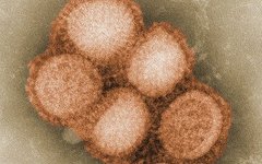 Вирус A/H1N1 под электронным микроскопом. Фото с сайта cdc.gov