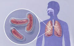 Бактерии туберкулеза. Фото с сайта webmd.com