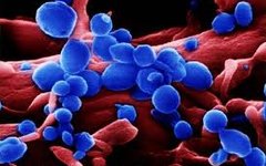 Вирус птичьего гриппа. Изображение с сайта actual-researches.ru