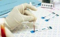 Тест на наркотики. Фото с сайта unapro.org