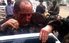 Раненый пилот сбитого украинского вертолета. Фото из Твиттера @NovorossiyaLive