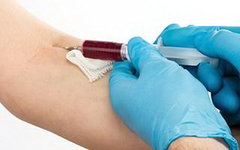 Фото с сайта renalandurologynews.com