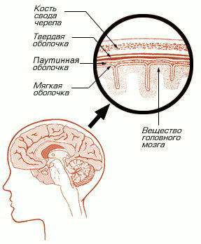 Доклад по теме Арахноидит