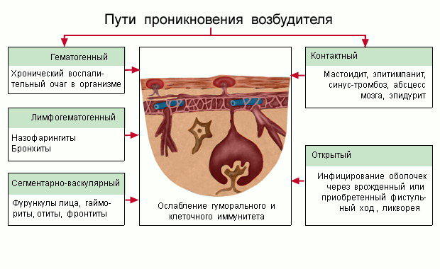 Реферат: Менингит