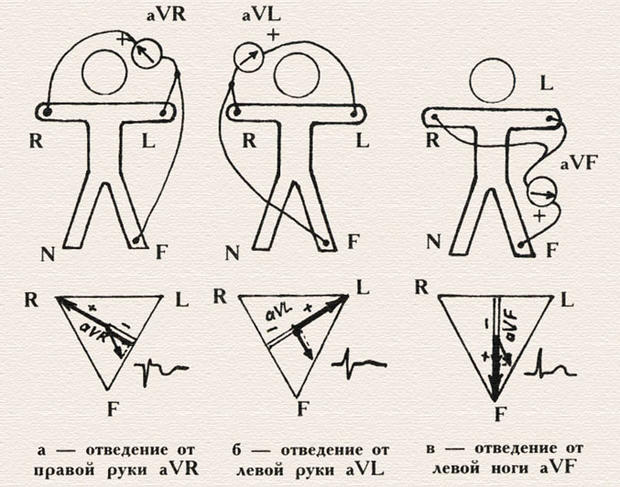 Как Снять Правильно Экг Наложение Электродов Фото