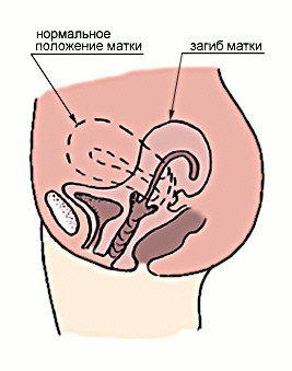 Реферат: Половые отклонения