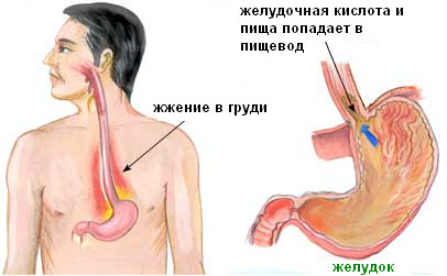 Фото с сайта http://www.webmedinfo.ru/