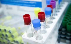 Разработан новый метод лечения неоперабельного рака поджелудочной железы