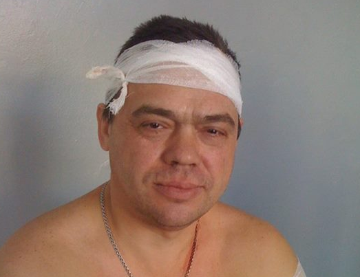 Раненый украинский солдат. Фото со страницы пресс-службы АТО в Facebook Раненый украинский солдат. Фото со страницы пресс-службы АТО в Facebook