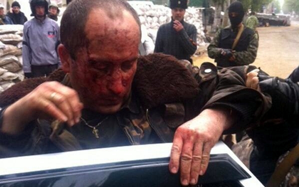 Раненый пилот сбитого украинского вертолета. Фото из Твиттера @NovorossiyaLive