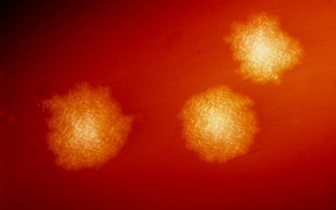 Clostridium difficile. Фото с сайта wikimedia.org Clostridium difficile. Фото с сайта wikimedia.org