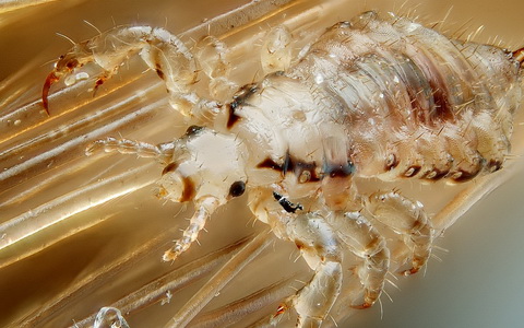 Человеческая вошь. Фото с сайта wikipedia.org Человеческая вошь. Фото с сайта wikipedia.org