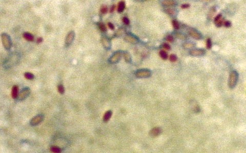 Mycobacterium smegmatis. Фото с сайта wikimedia.org Mycobacterium smegmatis. Фото с сайта wikimedia.org