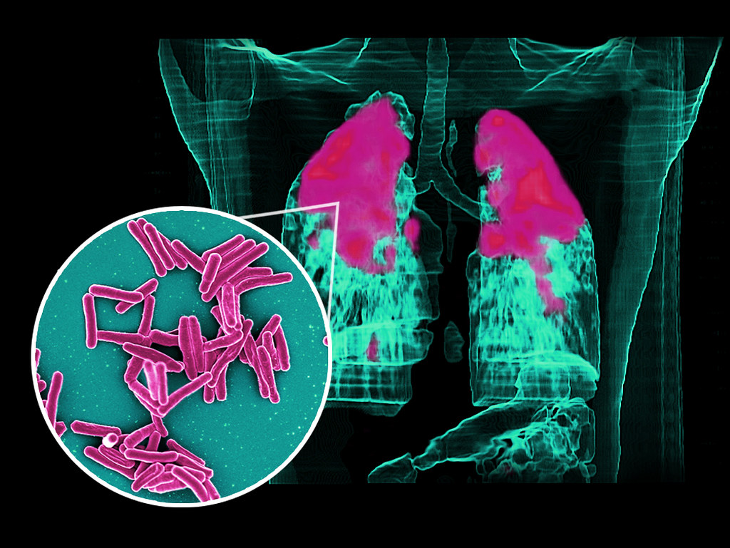 Фото © NIAID Laboratory of Clinical Immunology & Microbiology