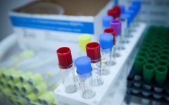 В Тверском детском санатории вспыхнула кишечная инфекция, фото KM.RU В Тверском детском санатории вспыхнула кишечная инфекция, фото KM.RU